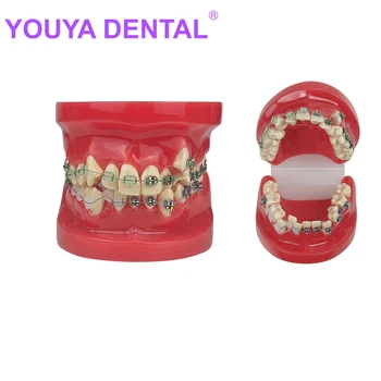 Ортодонтическая модель зубов Наполовину металлическая, наполовину керамическая скоба для практики студентов-стоматологов, изучающих стоматологическую модель стоматологического лечения